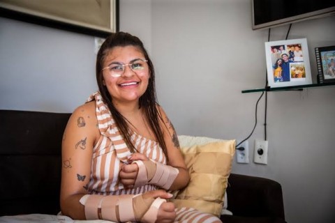 QUIXERAMOBIM - Jovem que teve mãos decepadas por ordem do ex-namorado recebe alta após nova cirurgia